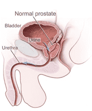 Fig.1 Prostate. (By National Cancer Institute, Public Domain, https://commons.wikimedia.org/wiki/File:Benign_Prostatic_Hyperplasia_nci-vol-7137-300.jpg)