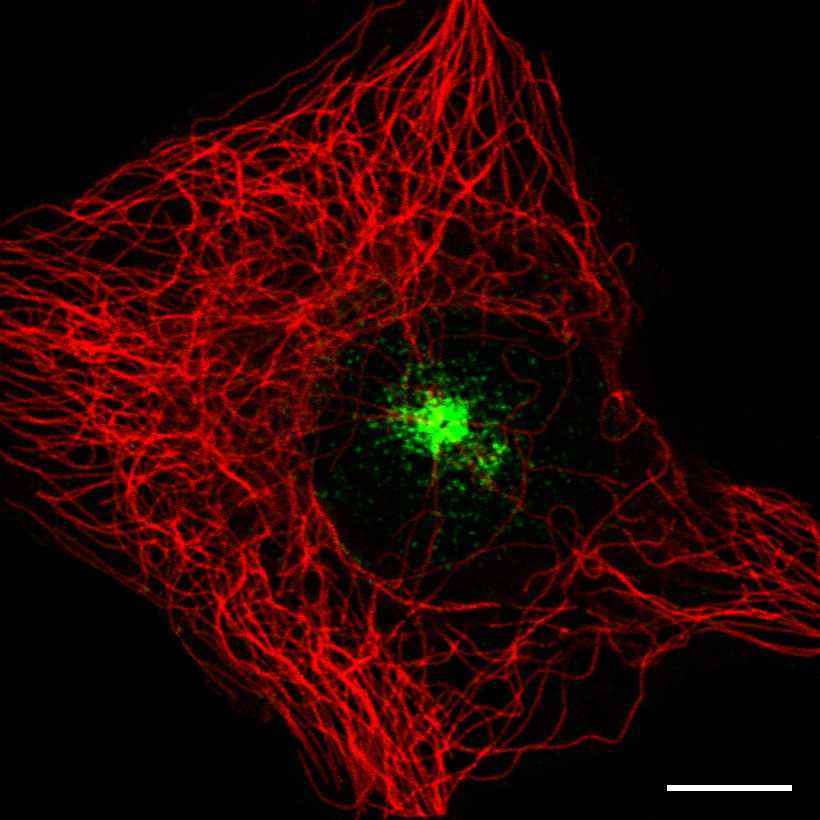 Fig.1 Microtubule organizing center. (https://v15.proteinatlas.org/learn/dictionary/cell/centrosome+(microtubule-organizing+center))