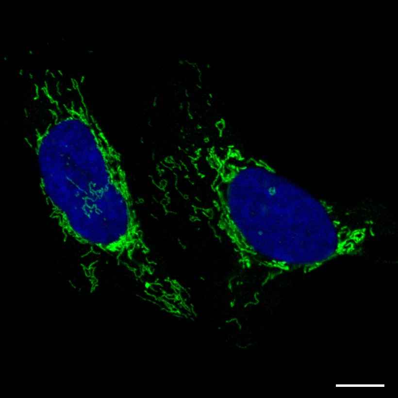 Fig.12 Mitochondria. (https://v18.proteinatlas.org/learn/dictionary/cell/mitochondria)