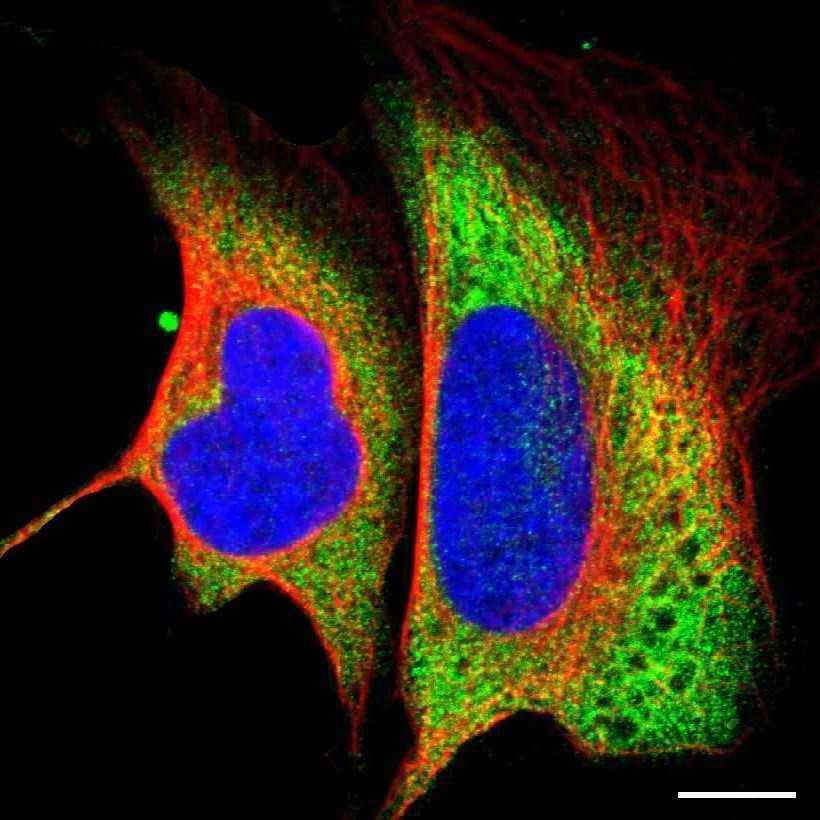 Fig.1 Cytosol. (https://v18.proteinatlas.org/learn/dictionary/cell/cytosol+4)