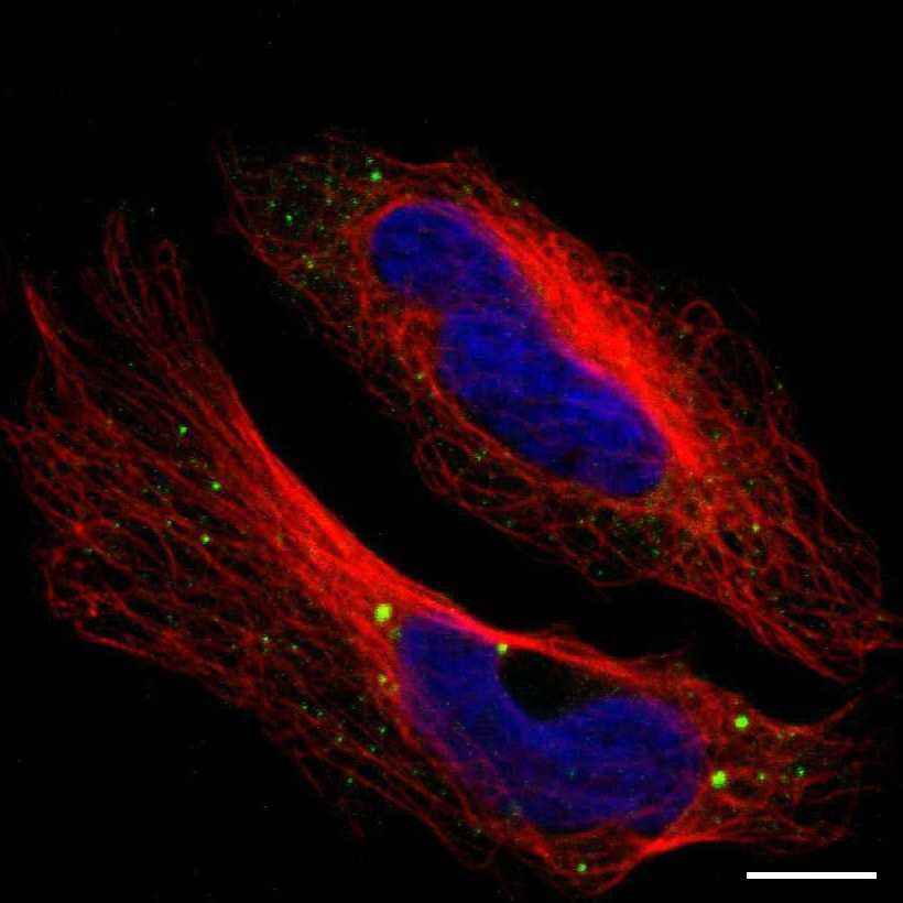 Fig.1 Cytoplasmic bodies. (https://v18.proteinatlas.org/learn/dictionary/cell/cytoplasmic+bodies)