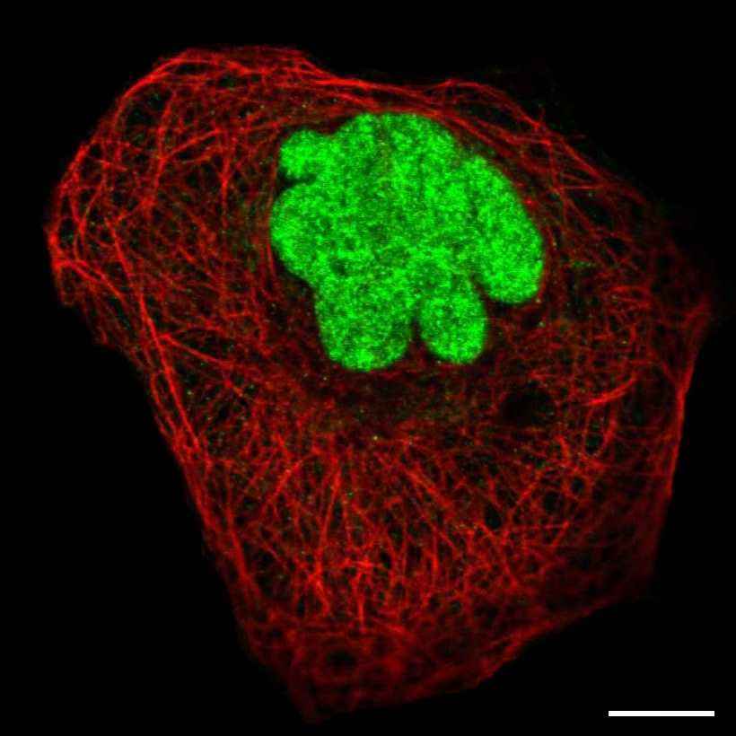 Fig.1 Nucleus. (https://v18.proteinatlas.org/learn/dictionary/cell/nucleus)