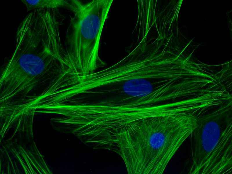 Fig.1 Actin filaments. (https://commons.wikimedia.org/wiki/File:F-actin_filaments_in_cardiomyocytes.jpg)