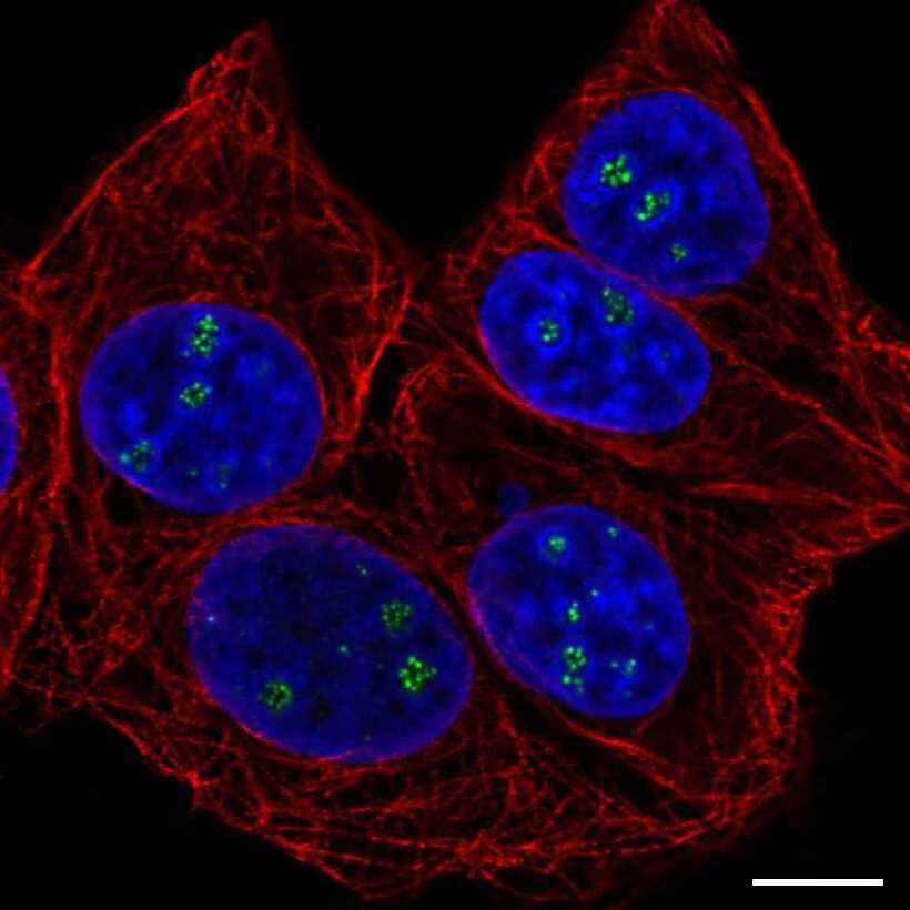 Fig.1 Nucleoli fibrillar center. (https://v18.proteinatlas.org/learn/dictionary/cell/nucleoli+6)