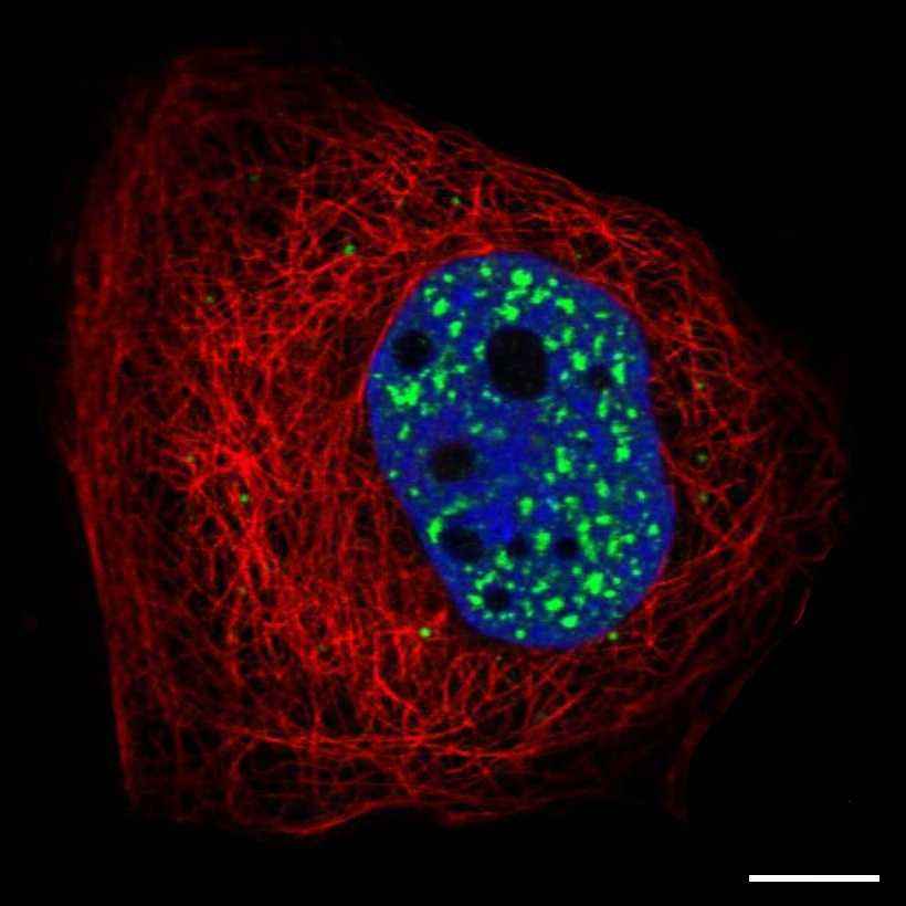 Fig.1 Nuclear speckles. (https://v18.proteinatlas.org/learn/dictionary/cell/nuclear+speckles)