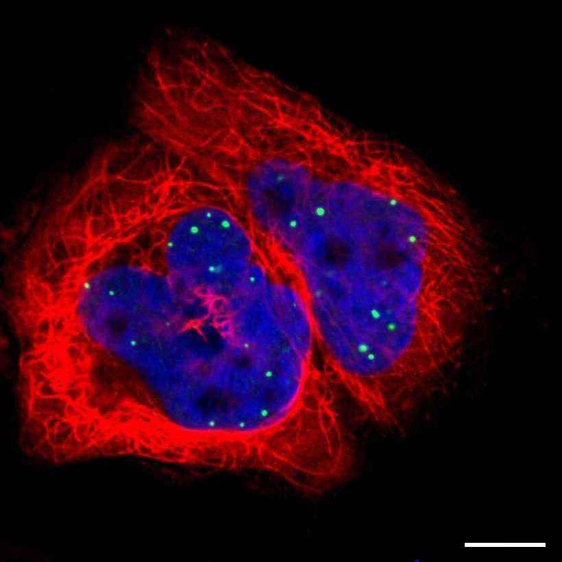 Fig.1 Nuclear bodies. (https://v18.proteinatlas.org/learn/dictionary/cell/nuclear+bodies)