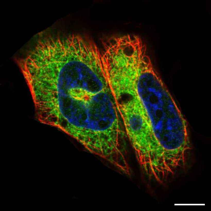 Fig.24 Endoplasmic reticulum. (https://v18.proteinatlas.org/learn/dictionary/cell/endoplasmic+reticulum+3)