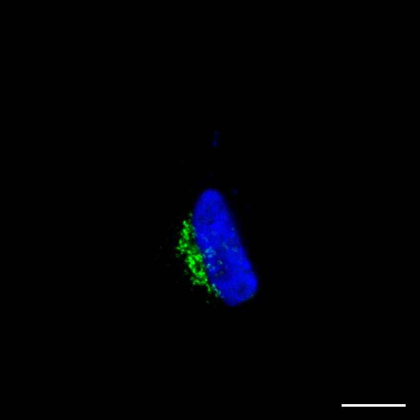 Fig.1 Golgi apparatus. (https://v18.proteinatlas.org/learn/dictionary/cell/golgi+apparatus)