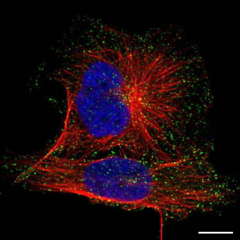 Fig.26 Vesicles. (https://v18.proteinatlas.org/learn/dictionary/cell/vesicles)