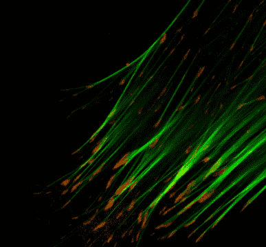 Fig.1 Focal adhesions. (https://commons.wikimedia.org/wiki/File:Focaladhesiondetail.jpg)