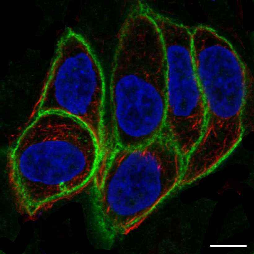 Fig.31 Plasma membrane. (https://v18.proteinatlas.org/learn/dictionary/cell/plasma+membrane+4)