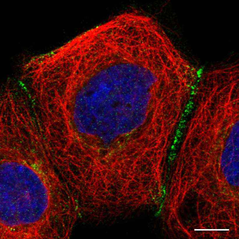 Fig.1 Cell junctions. (https://v18.proteinatlas.org/learn/dictionary/cell/cell+junctions+4)