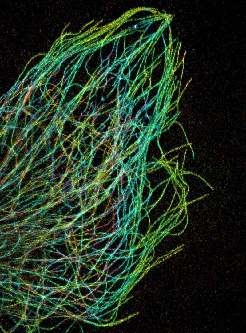 Fig.4 Microtubules. (By Pakorn Kanchanawong and Clare Waterman, Public Domain, https://en.wiktionary.org/wiki/mikrotubula#/media/File:Microtubules_in_the_leading_edge_of_a_cell.tif)