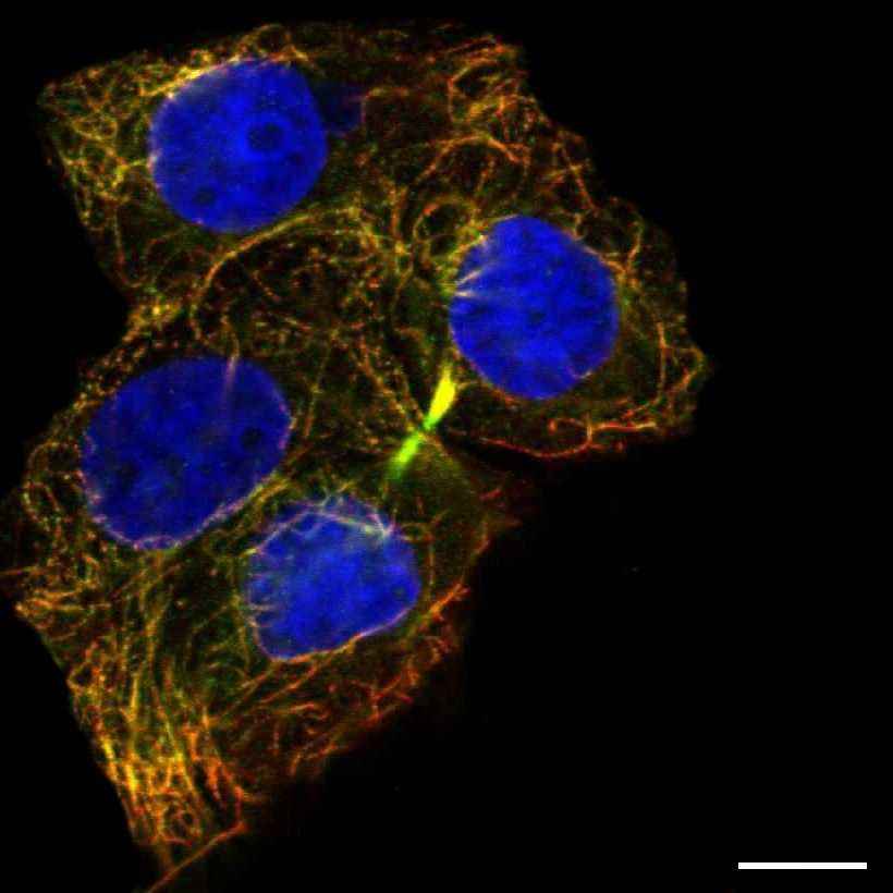 Fig.1 Cytokinetic bridge. (https://v18.proteinatlas.org/learn/dictionary/cell/cytokinetic+bridge)