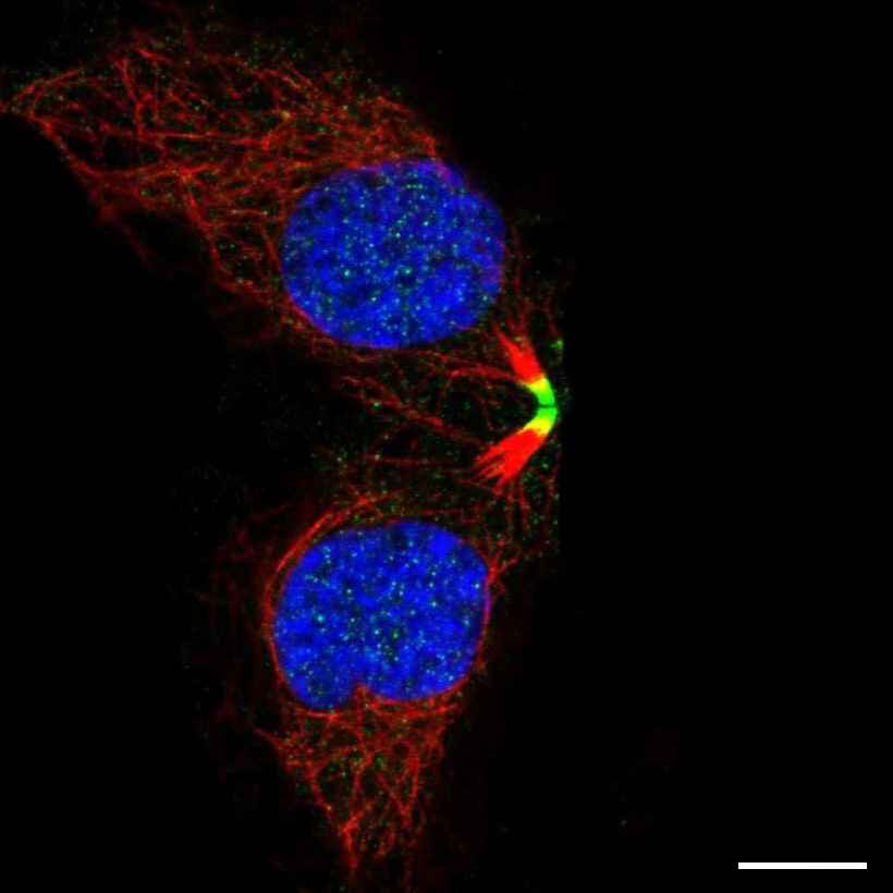 Fig.1 Midbody. (https://v18.proteinatlas.org/learn/dictionary/cell/cytokinetic+bridge+4)