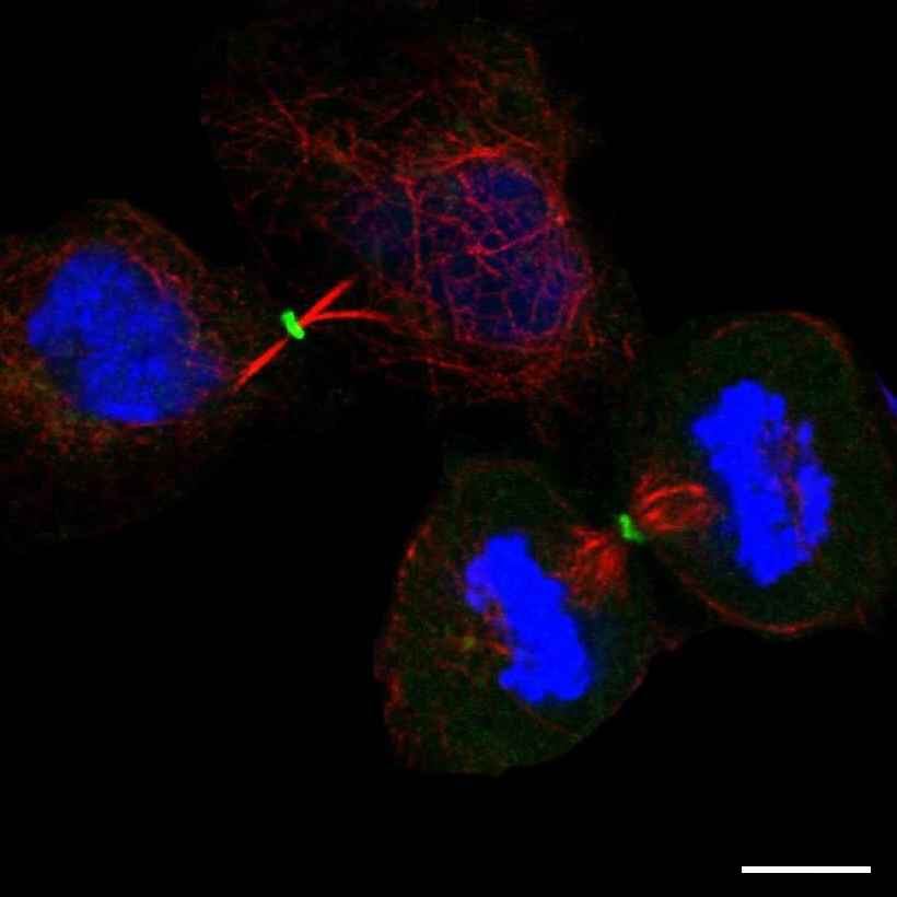 Fig.1 Midbody ring. (https://v18.proteinatlas.org/learn/dictionary/cell/cytokinetic+bridge+7)