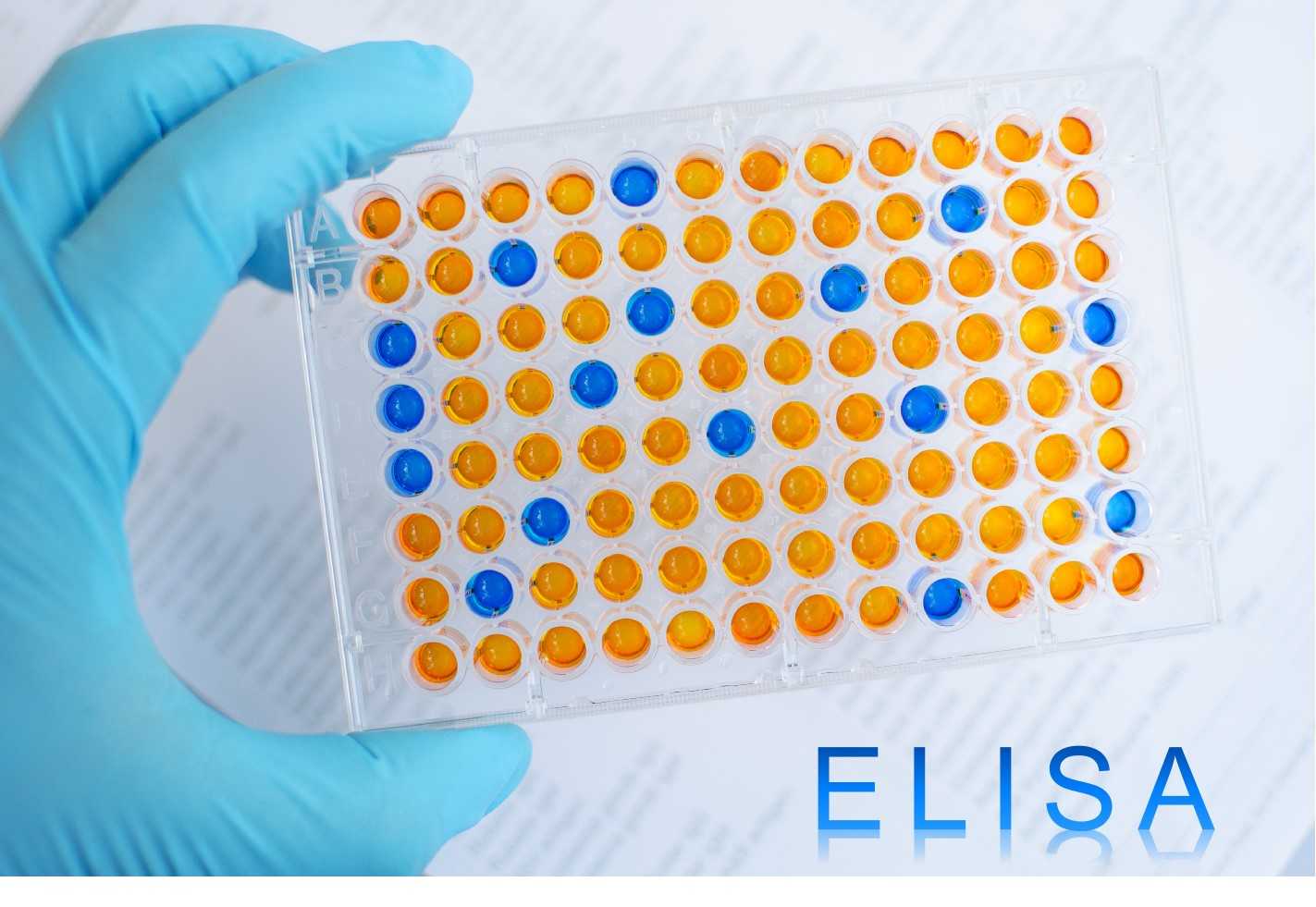 Fig.1 ELISA. (Creative Biolabs Authorized)