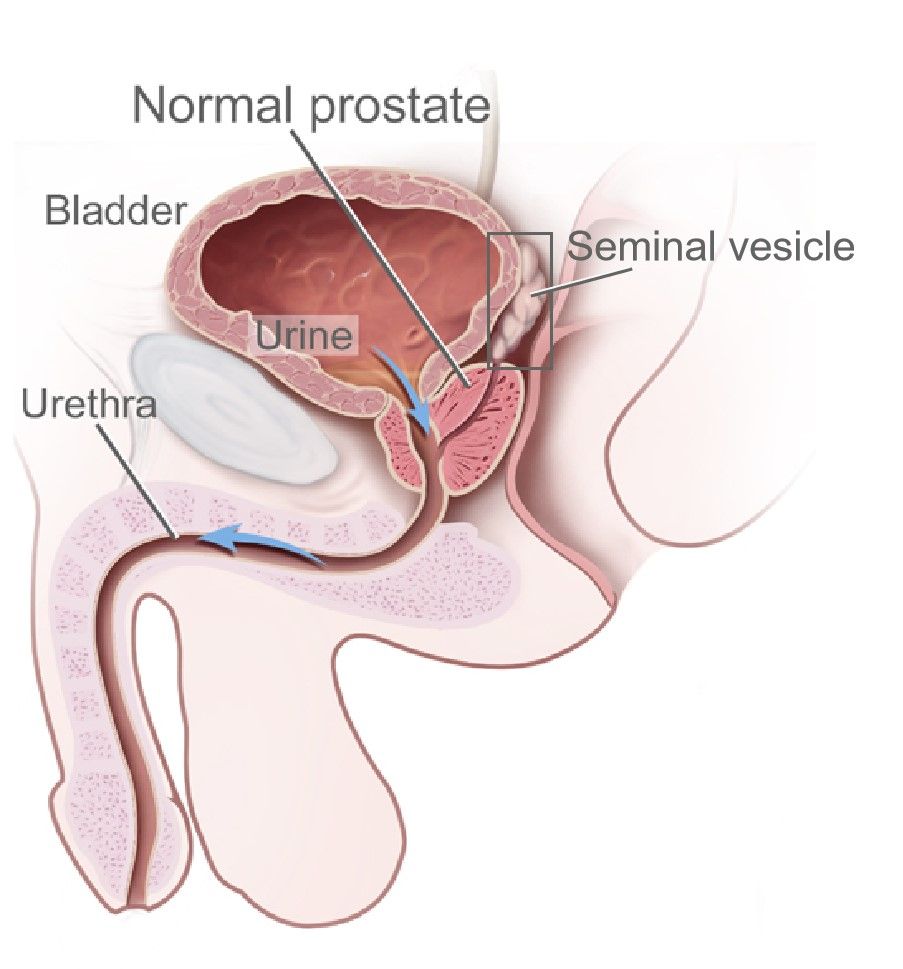 Fig.1 Seminal vesicle. (By National Cancer Institute, Public Domain, https://commons.wikimedia.org/wiki/File:Benign_Prostatic_Hyperplasia_nci-vol-7137-300.jpg) 