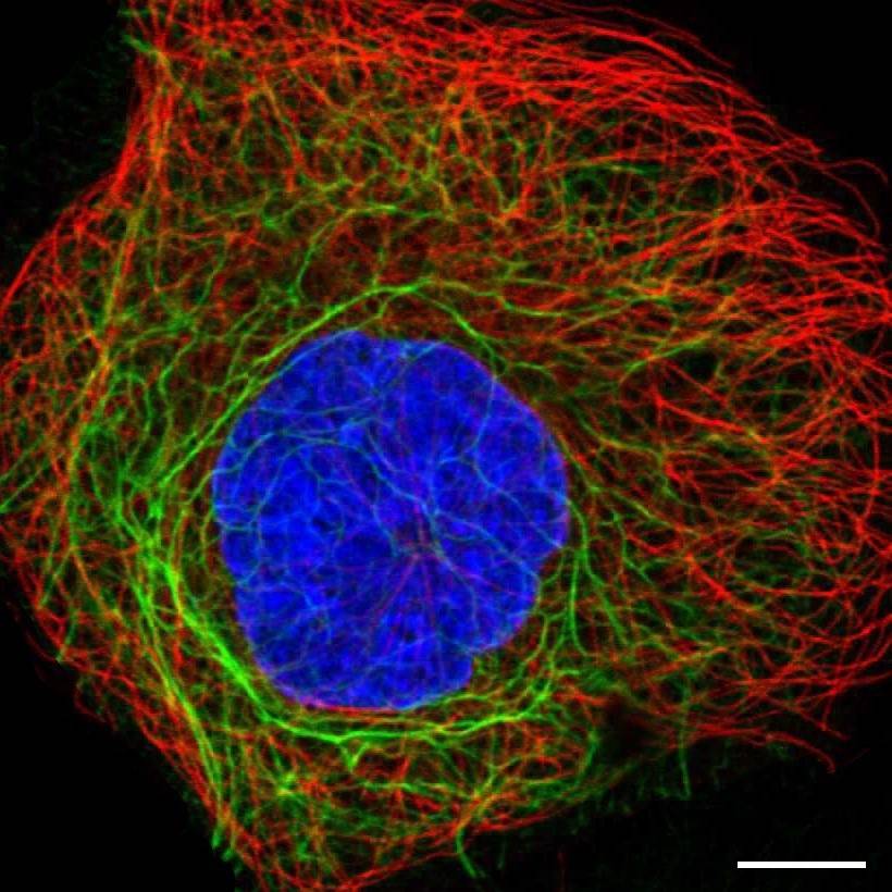 Fig.1 Intermediate filaments. (https://v15.proteinatlas.org/learn/dictionary/cell/cytoskeleton+(intermediate+filaments)+3)