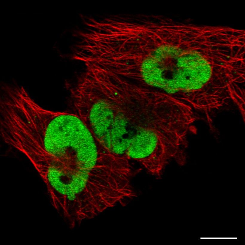 Fig.1 Nucleoplasm. (https://v18.proteinatlas.org/learn/dictionary/cell/nucleus+5)