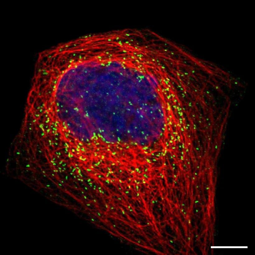 Fig.27 Peroxisomes. (https://v18.proteinatlas.org/learn/dictionary/cell/vesicles+7)