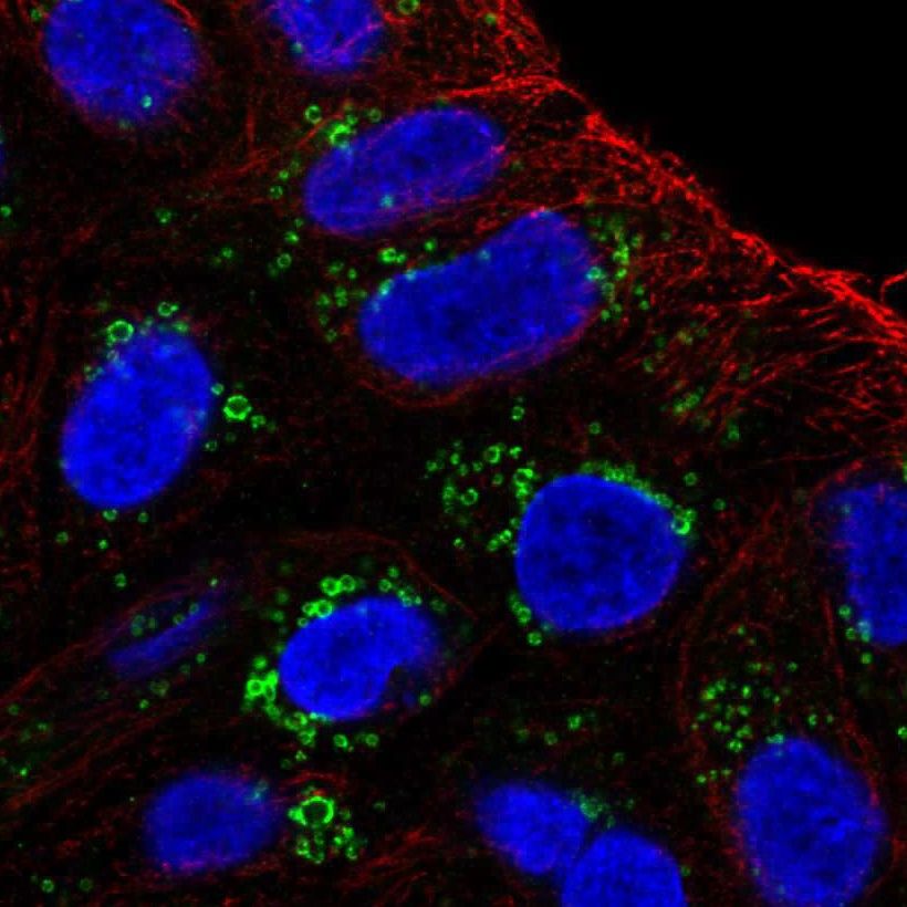 Fig.1 Lipid droplets. (https://v18.proteinatlas.org/learn/dictionary/cell/vesicles+9)