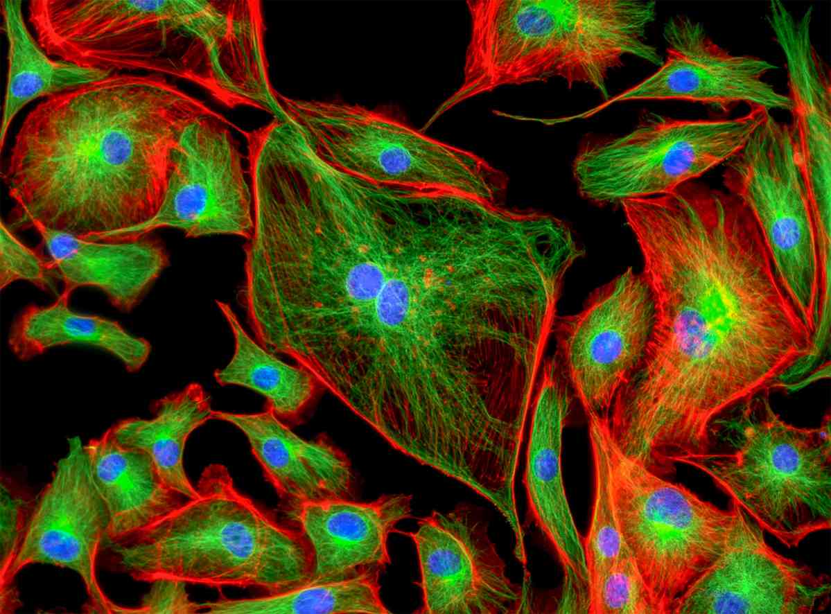 Fig.1 Multicolor immunofluorescence. (Creative Biolabs Authorized)