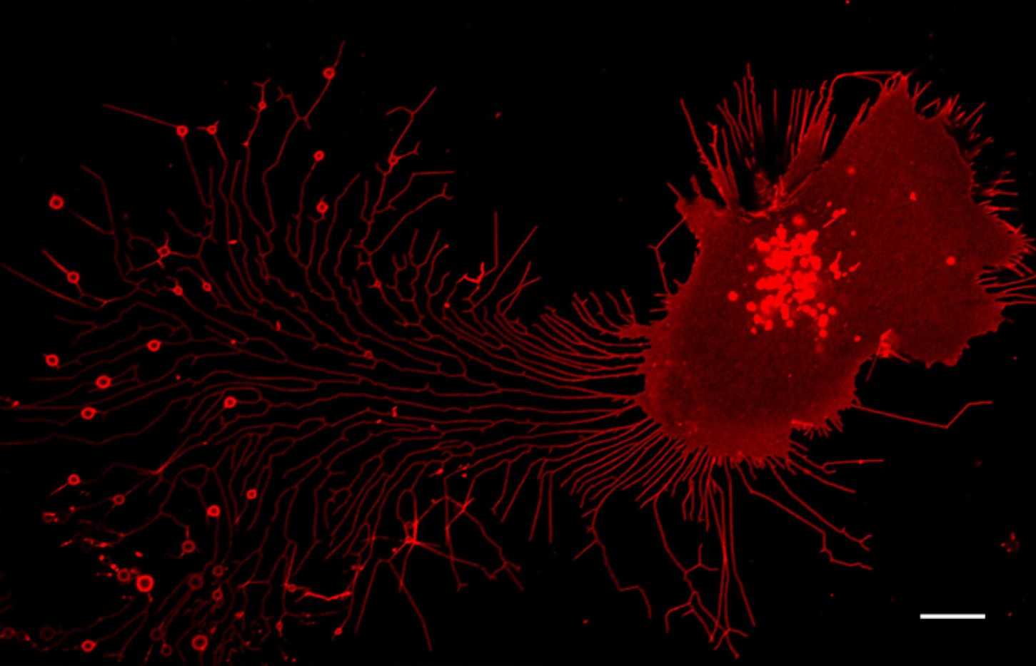 Fig.33 Migrasomes. (Yu & Li, 2022)