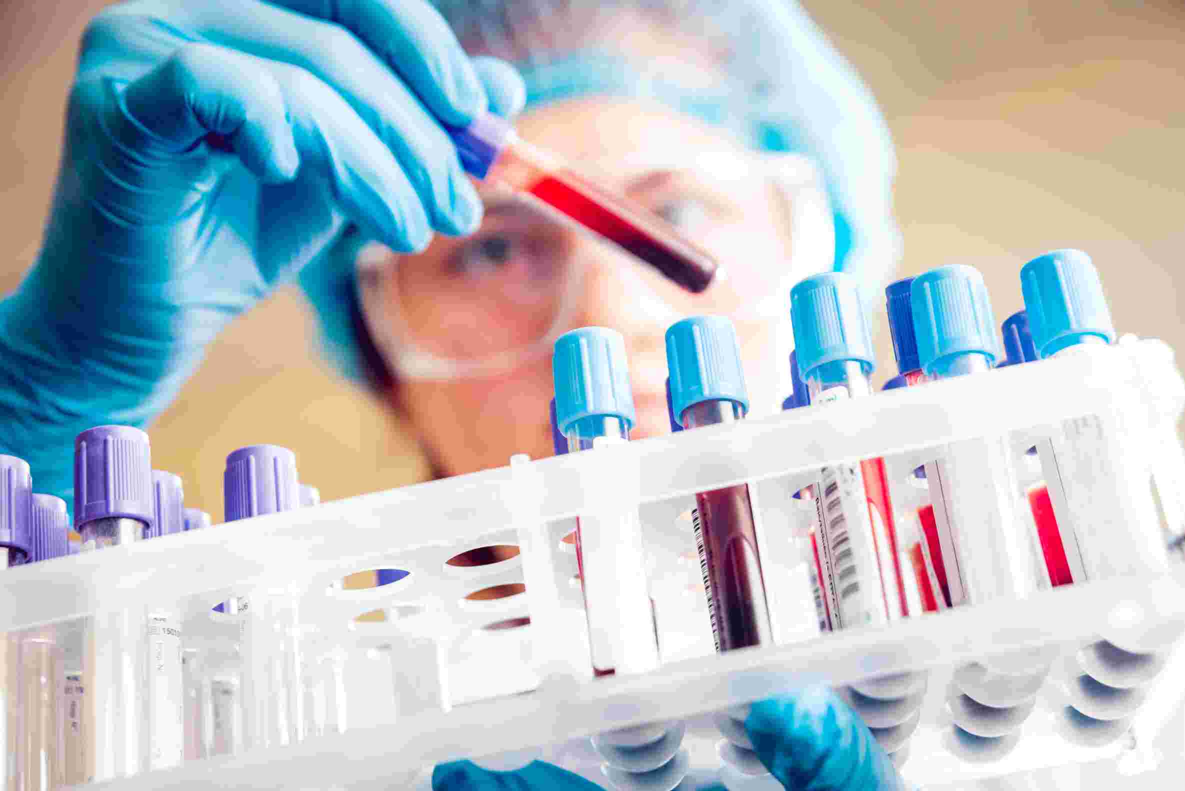 Fig.2 Coronavirus testing. (Creative Biolabs Authorized) 