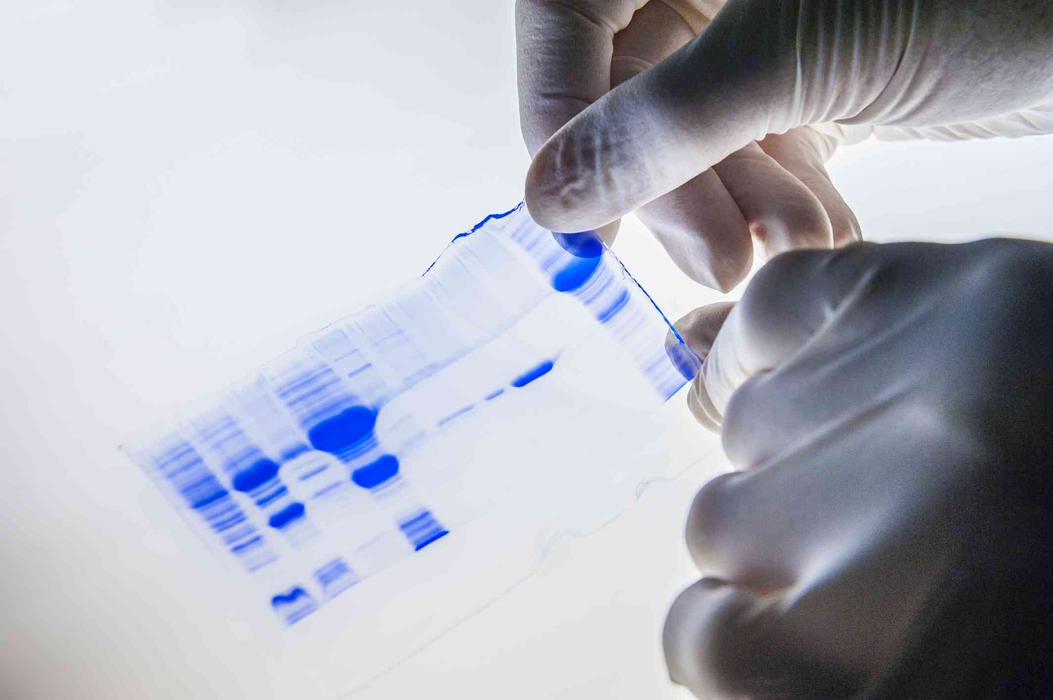 Fig.1 Western blot. (Creative Biolabs Authorized)